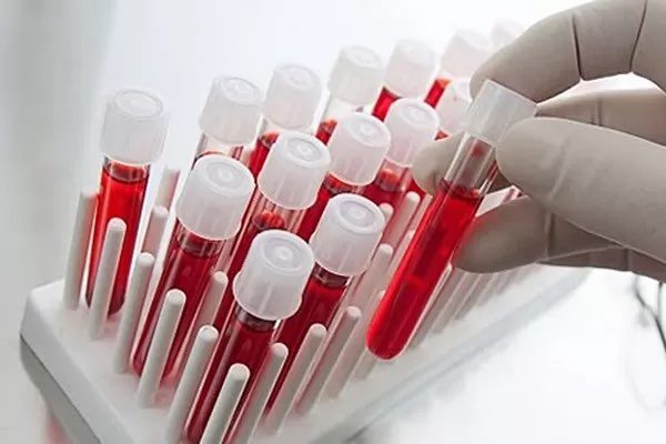 It is interesting! 9 major blood indicators of your health